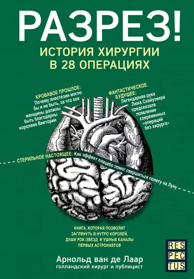 Разрез! История хирургии в 28 операциях - Арнольд Ван Де Лаар - Серии Аудиокниг 🔊 Цикл Аудиокниг 🆓 Литрес 100% Бесплатно